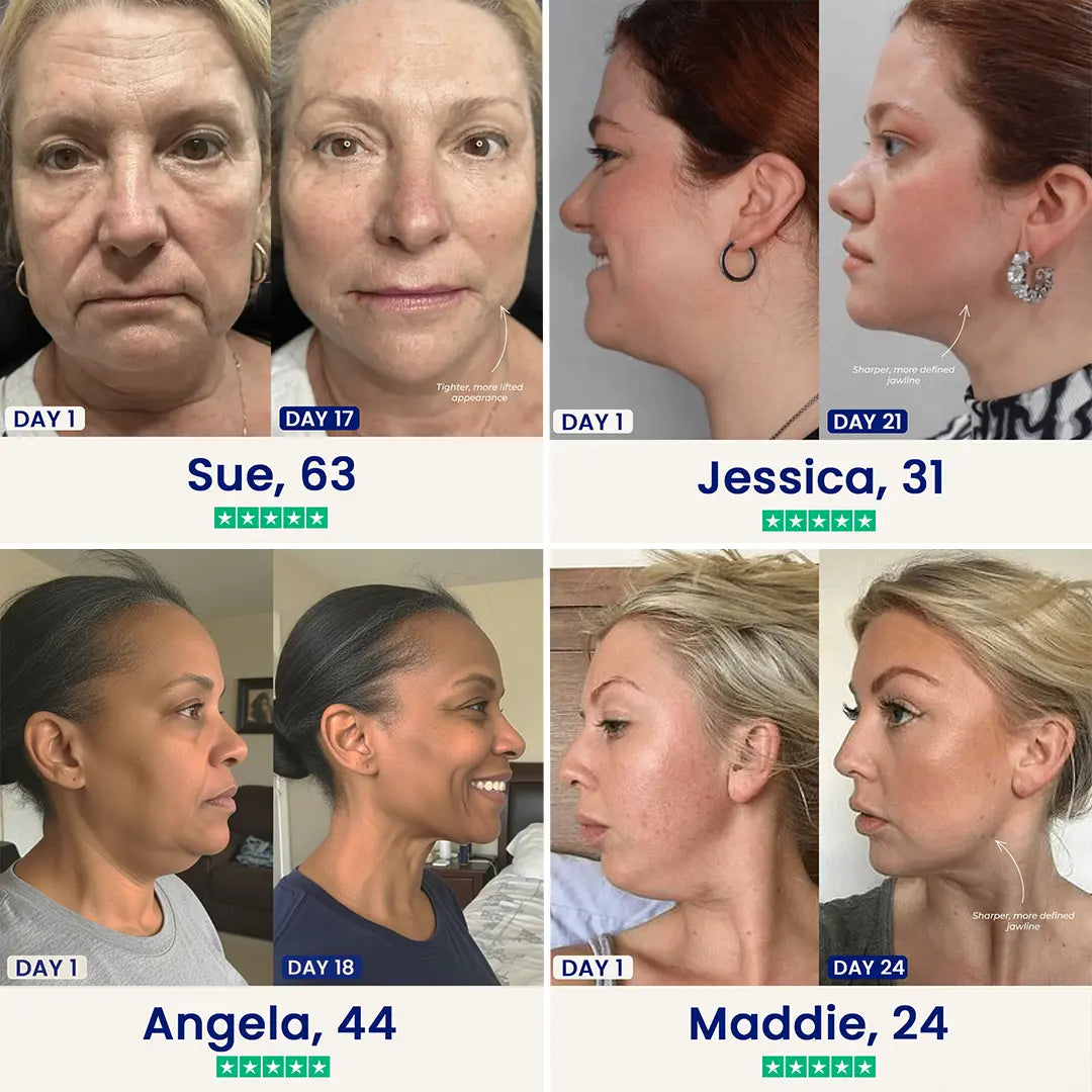 CactoLift™ V-Line Mewing Band – Cooling Jawline Support & Pore Care
