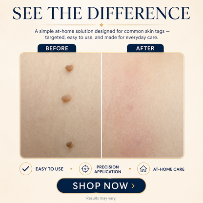 TAGLISSE™ Auto Skin Tag Remover Kit