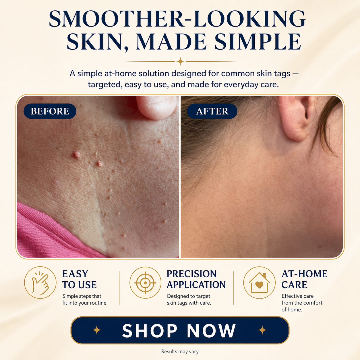 TAGLISSE™ Auto Skin Tag Remover Kit