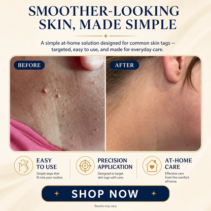 TAGLISSE™ Auto Skin Tag Remover Kit
