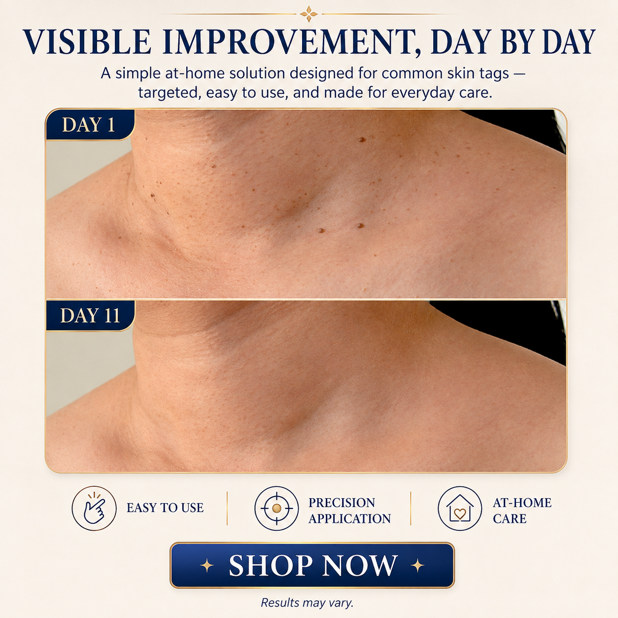 TAGLISSE™ Auto Skin Tag Remover Kit