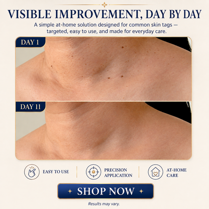 TAGLISSE™ Auto Skin Tag Remover Kit