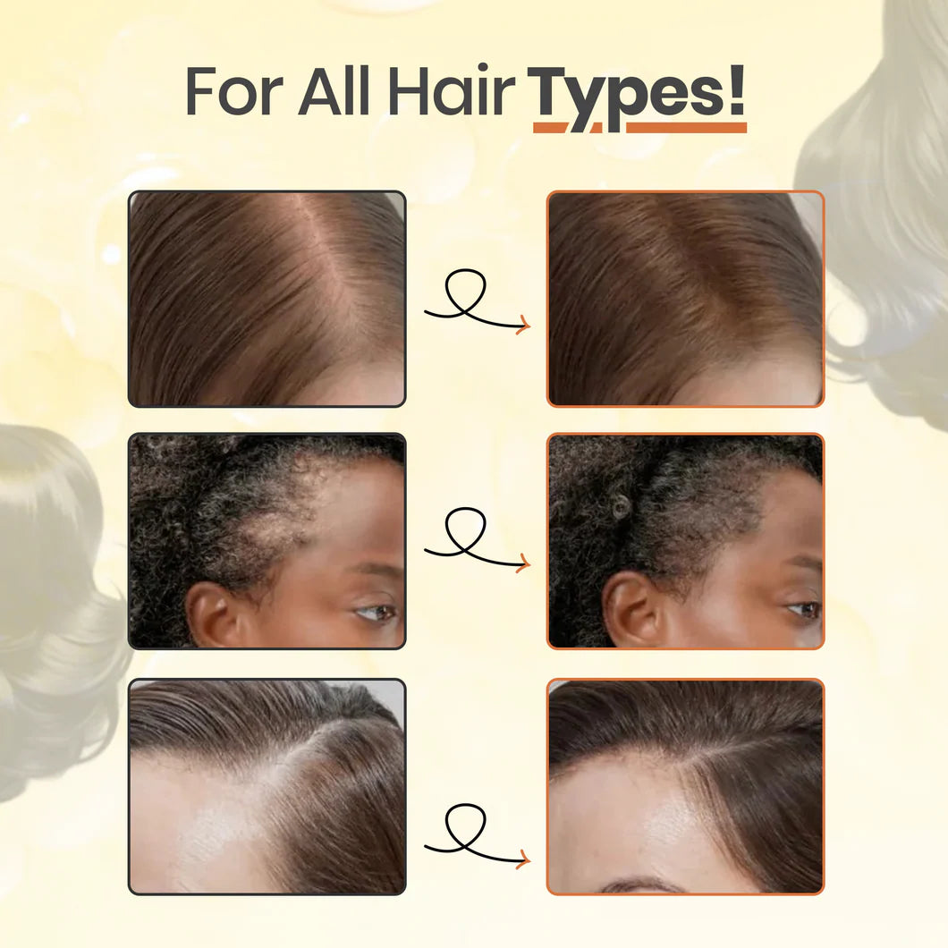 Tevo™ Growturn Hair Growth Serum