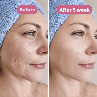 Tevo™  - Korean PDRN Pink Collagen Volume Multi Balm
